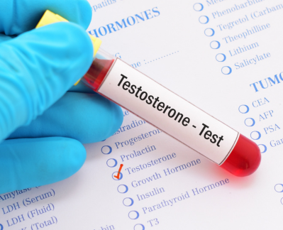 The Impact of Diet on Testosterone Levels What Every Man Should Know